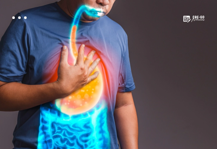 CRF-GO | Novo registro de genérico amplia acesso ao tratamento do refluxo gastroesofágico