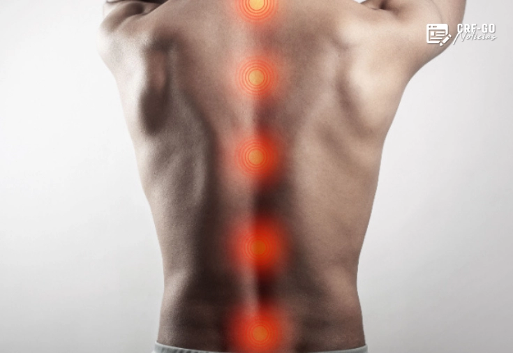 CRF-GO | Polilaminina avança em testes clínicos e reacende expectativas no tratamento de lesões medulares