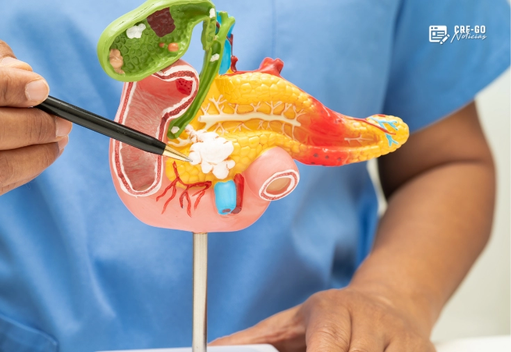 CRF-GO | Anvisa registra aumento de notificações de pancreatite associadas a canetas emagrecedoras